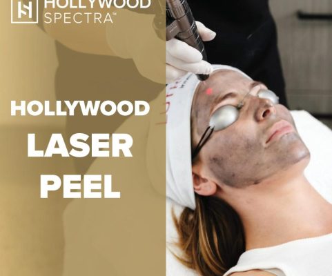 Hollywood Laser Peel