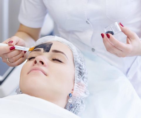 acne peel