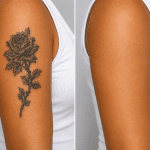 tattoo removal treatment results Brows and Beyond