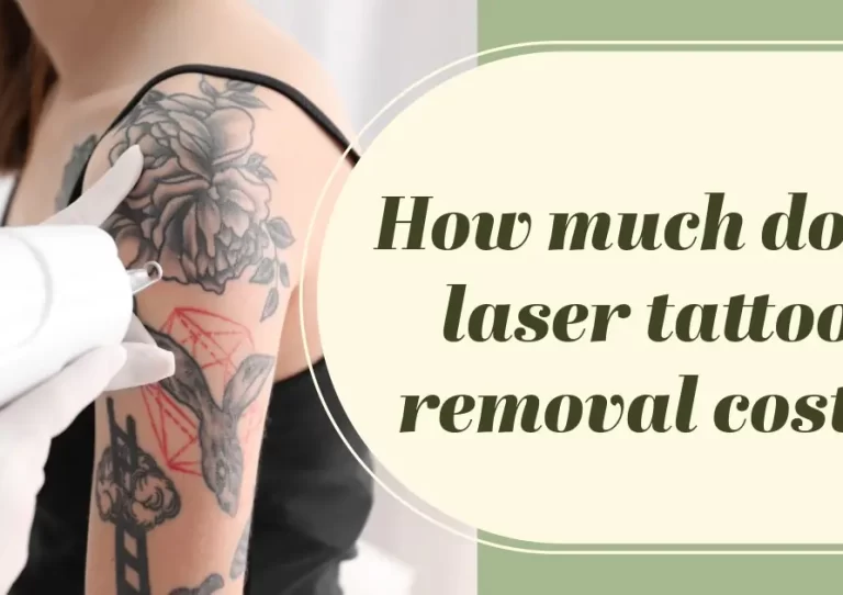 How much does laser tattoo removal cost