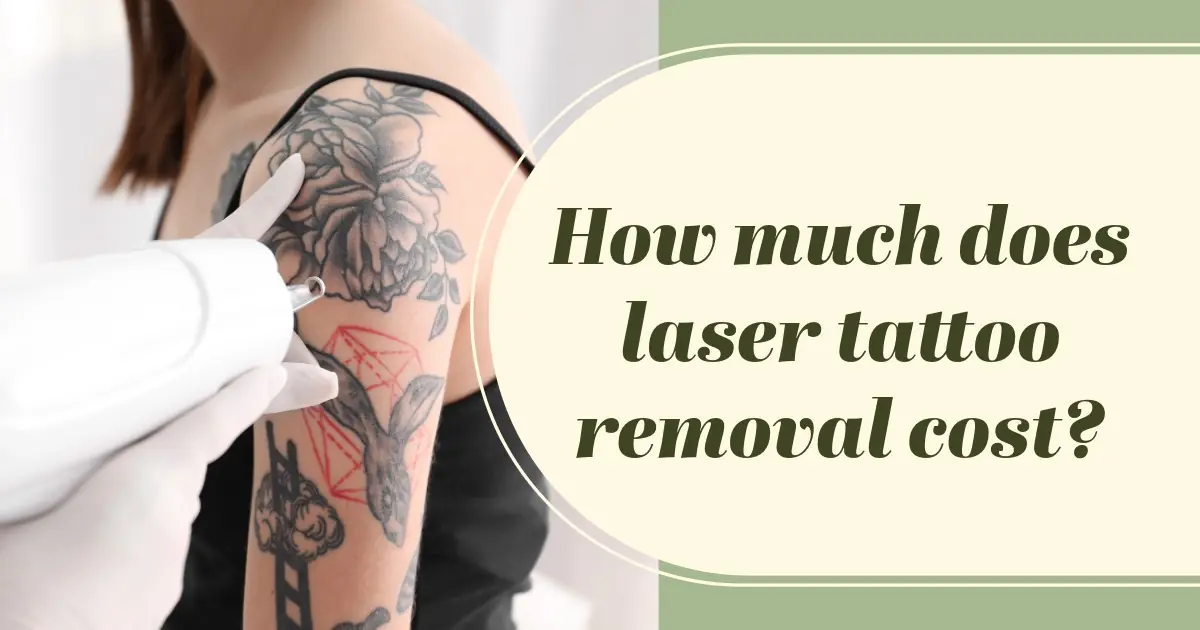 How much does laser tattoo removal cost