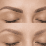 Brow tattoo removal transformation Auckland